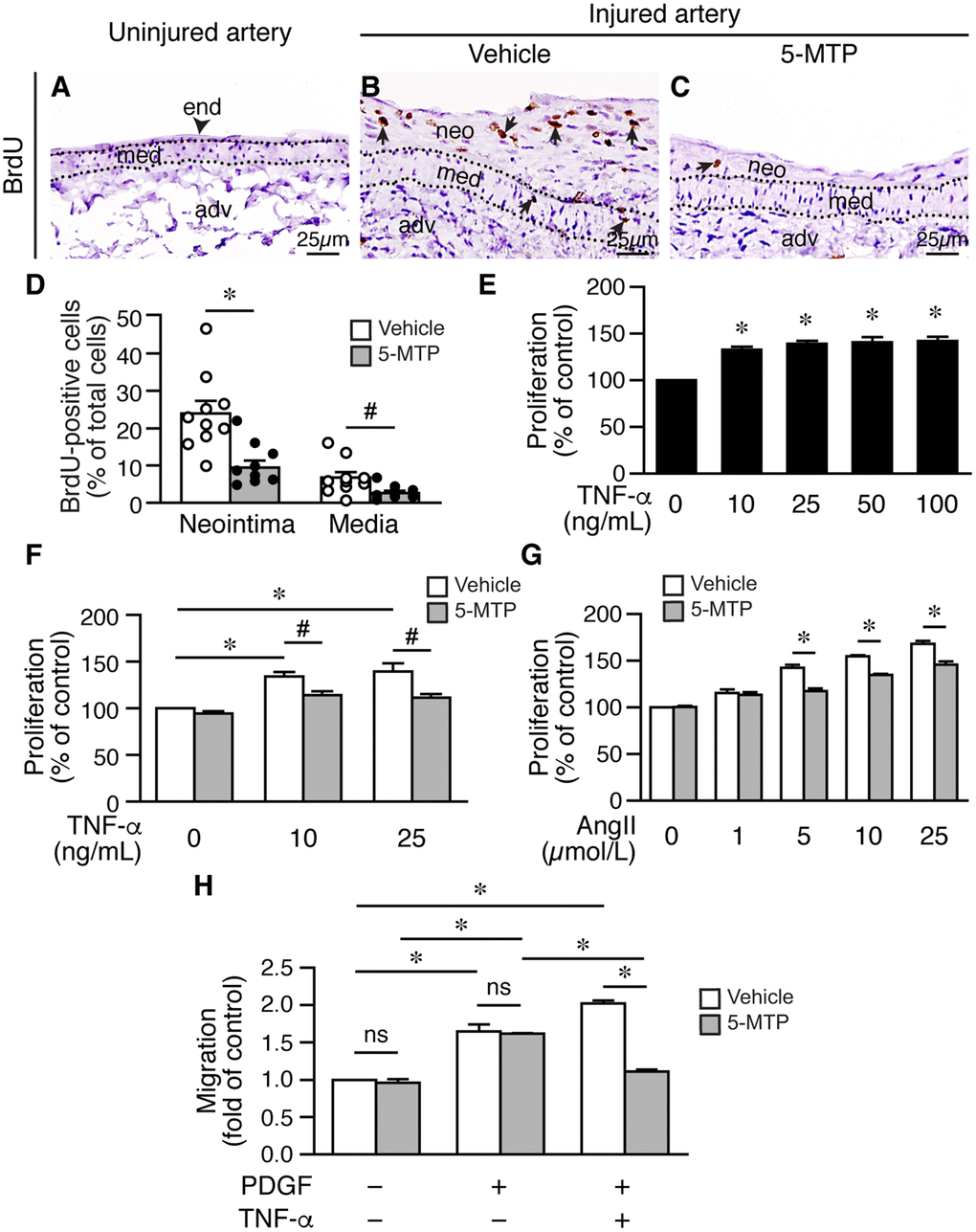 5-MTP decreases VSMC proliferation following arterial injury. (A–C) Femoral arteries were harvested 2 weeks after injury. Arterial sections were immunostained with BrdU antibody (brown) to detect proliferating cells. Arrowhead indicates endothelium (end) and arrows indicate BrdU-positive brown nuclei. adv, adventitia; med, media; neo, neointima. (D) BrdU-positive cells were quantified and expressed as % of total cells in the neointima or media. 5-MTP decreased BrdU incorporation in the neointima (n=10 each; *ppE) Serum-starved VSMCs were treated with TNF-α for 24 h, proliferation was then measured and normalized to control without TNF-α (n=3, *pF) Serum-starved VSMCs in the presence of vehicle or 5-MTP were treated with TNF-α for 24 h, proliferation was then measured and normalized. TNF-α increased VSMC proliferation (n=3 each, *pp=0.05). (G) VSMCs were treated as in (F), stimulated without or with different concentrations of angiotensin II (AngII) for 24 h. Cell proliferation was then measured as in (F). n=3 each, *pH) VSMCs were treated as in (F), stimulated with or without TNF-α for 24 h, and then transwell migration assays performed. Cells migrated through membranes were quantified after 4 h. The migrated cell number of vehicle control without TNF-α treatment and without PDGF-BB as a chemoattractant was set as 1. 5-MTP had no effect on migration under this condition. TNF-α increased VSMC migration (n=3, *pp=0.001). ns, no significance.