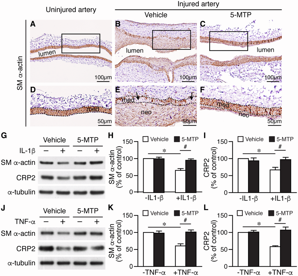 5-MTP prevents smooth muscle marker downregualtion following arterial injury. (A–C) SM α-actin immunostaining (brown) of 2-week-injured femoral arteries. (D–F) Magnified area from boxed area of (A–C), respectively. Dashed lines demarcate media area. Arrows in (E) indicate areas lacking brown staining. med, media; neo, neointima. (G) Primary VSMCs were treated with IL-1β and 5-MTP and then Western performed to detect SM α-actin and CRP2. Quantitation of SM α-actin (H) and CRP2 (I) protein levels (n=3 each; *p#pJ) VSMCs were treated with TNF-α and 5-MTP and then Western performed. Quantitation of SM α-actin (K) and CRP2 (L) protein levels (n=3 each; *p#p