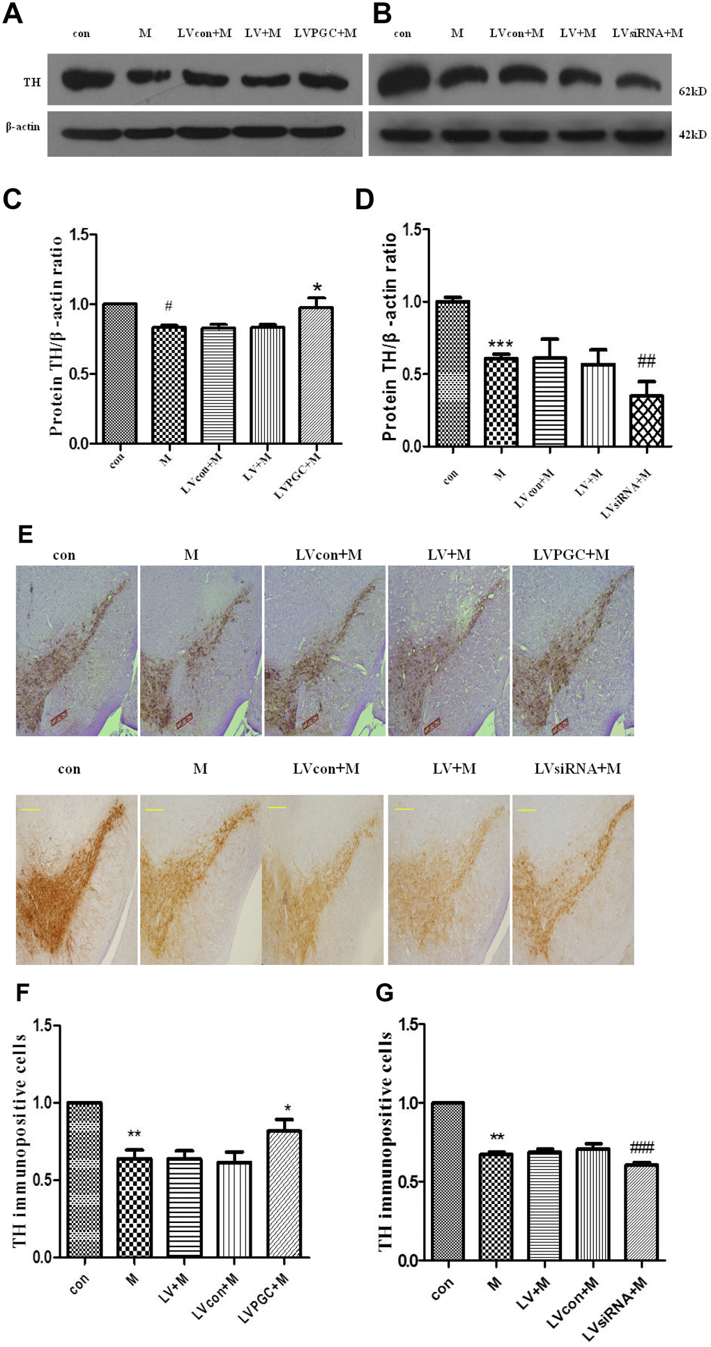 Expression of TH and TH immunopositive cells in the substantia nigra of C57BL mice. (A–D) TH protein expression detected using western blotting; (E–G) TH immunopositive cells (scale bar, 20 μm. magnification, ×400). Quantification of the results from the three experiments are represented as the means ± SD. The groups were con (con group), M (MPTP group), LVcon+M (solvent of lentivirus+MPTP group), LV+M (lentivirus+MPTP group), LVPGC+M (LV-PGC-1α+MPTP group), LVsiRNA+M (LV-PGC-1αsiRNA+MPTP group);*P