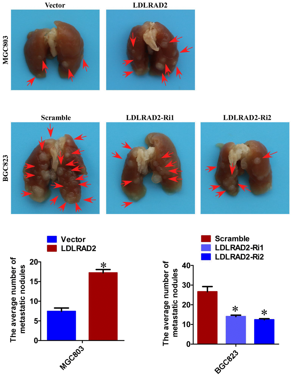 LDLRAD2 promotes GC metastasis in vivo. The number of lung metastatic nodules from mice injected with LDLRAD2-overexpresion MGC-803 cell was much more than that from control mice, while the number of lung metastatic nodules from mice injected with LDLRAD2-silenced BGC-823 cell was less than that from control mice.