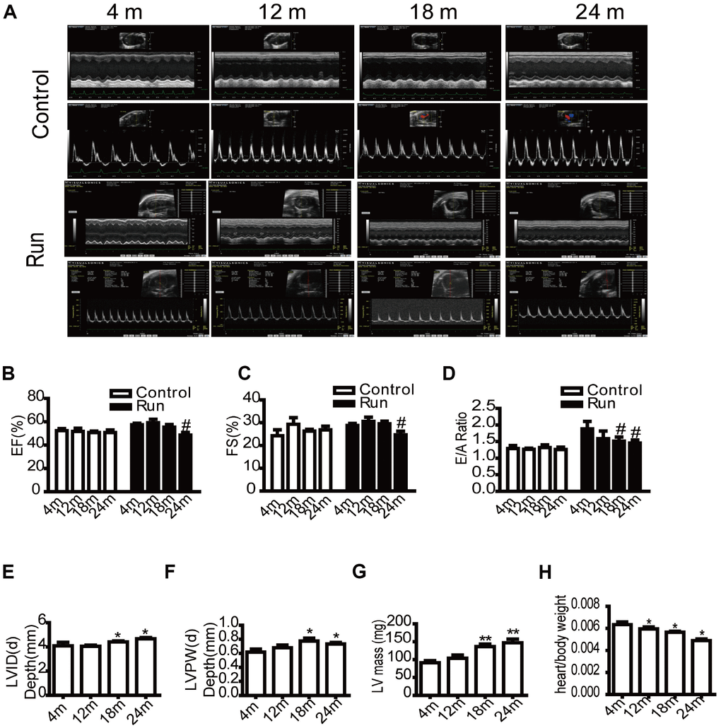 The cardiac reserve function decreases in aging mice. Echocardiography of the mice (A). Eject factor (EF, %) (B). Fractional shortening (FS, %) (C). The ratio of the early to late ventricular filling velocities (E/A ratio) (D). Left ventricular end-diastolic diameter (LVID(d), mm) (E). Left ventricular posterior wall end-diastolic thickness (LVPW(d), mm) (F). Left ventricular mass (LV mass, mg) (G). The ratio of the heart weight to total weight (H). Data are represented as mean +/- SEM. n = 6 per group. *PP