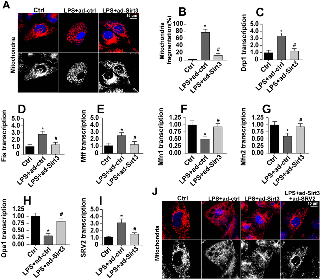 SRV2-associated mitochondrial fission is activated by LPS and inhibited by Sirt3. (A, B) Mitochondrial fission was measured via immunofluorescence. Numbers of fragmented mitochondria were recorded in BV-2 cells treated with LPS and/or transfected with Sirt3 adenovirus. (C–H) Transcription of mitochondrial fission-related factors. RNA was isolated from BV-2 cells treated with LPS and/or transfected with Sirt3 adenovirus. qPCR was used to measure changes in levels of mitochondrial fission-related proteins. (I) SRV2 expression was measured via qPCR. (J) Mitochondrial fission was measured in BV-2 cells transfected with SRV2 adenovirus via immunofluorescence. Numbers of fragmented mitochondria were recorded in BV-2 cells treated with LPS and/or transfected with Sirt3 adenovirus. *P