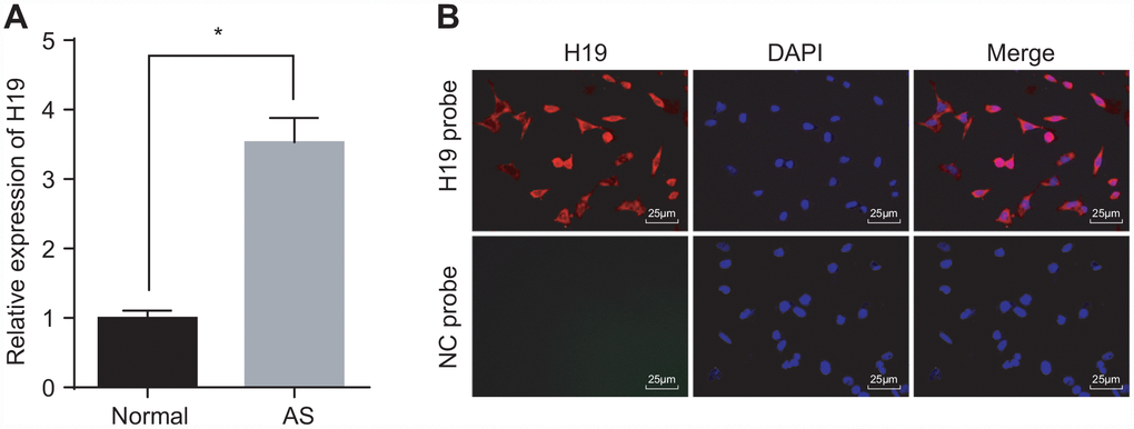 High expression of H19 is found in AS aortic tissues. (A) The expression pattern of H19 in normal and AS aortic tissues determined by RT-qPCR. * p vs. the control group. The data were measurement data and expressed by mean ± standard deviation. Data differences between two groups were analyzed by unpaired t-test. n = 6. (B) The subcellular localization of H19 detected by FISH assay (× 400). The experiment was repeated three times independently.