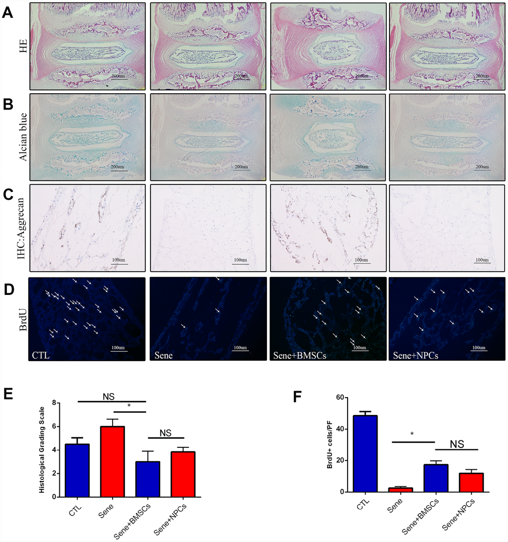 Staining with HE, Alcian blue, immunohistochemistry of aggrecan and BrdU between CTL, Sene, Sene+BMSCs and Sene+NPCs groups. n=5, Scale bar, as indicated. Values represent means±S.D. Significant difference between different groups is indicated as *P 