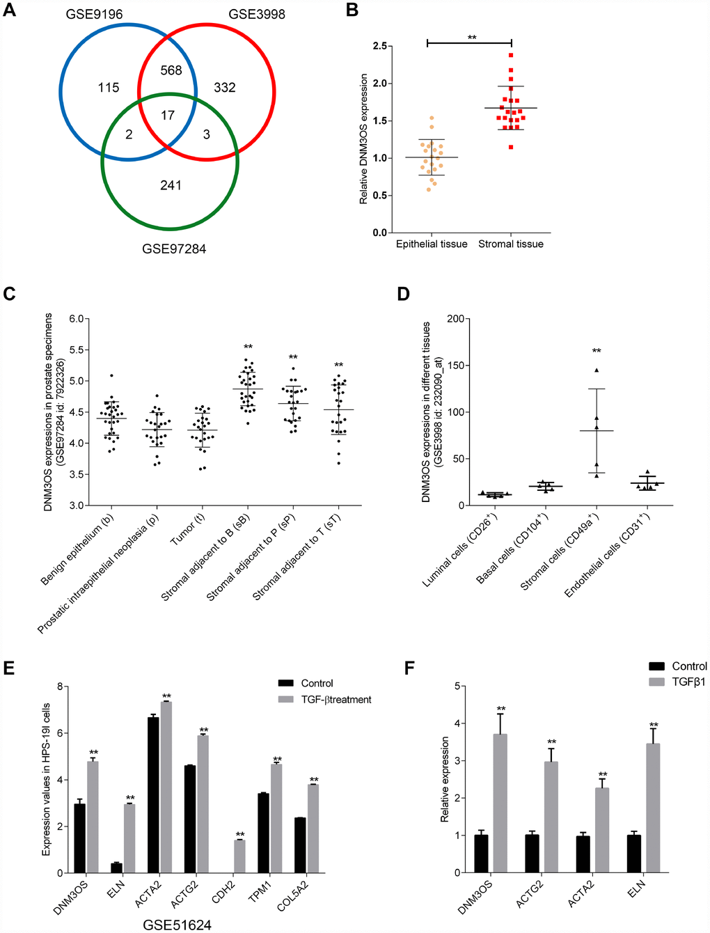 Selection of lncRNAs associated with benign prostatic hyperplasia (BPH) stroma and highly-expressed in prostate stromal tissues (A) Three microarray profiles reported differentially-expressed lncRNAs in prostate stromal tissues compared to prostatic epithelium (GSE9196, GSE3998, and GSE97284). The expression of lncRNA DNM3OS in (B) epithelial and stroma tissues according to GSE9196; (C) benign epithelium, prostatic intraepithelial neoplasia, tumors, stroma adjacent to benign epithelium, stroma adjacent to prostatic intraepithelial neoplasia, and stromal adjacent to tumor according to GSE97284; and (D) luminal cells, basal cells, stromal cells, and endothelial cells. (E) Differentially- expressed genes in the benign stromal cell line HPS-19I upon TGFβ treatment according to GSE51624. (F) Differentially- expressed genes in primary prostate stromal cells (PrSCs) upon TGFβ treatment. *PP