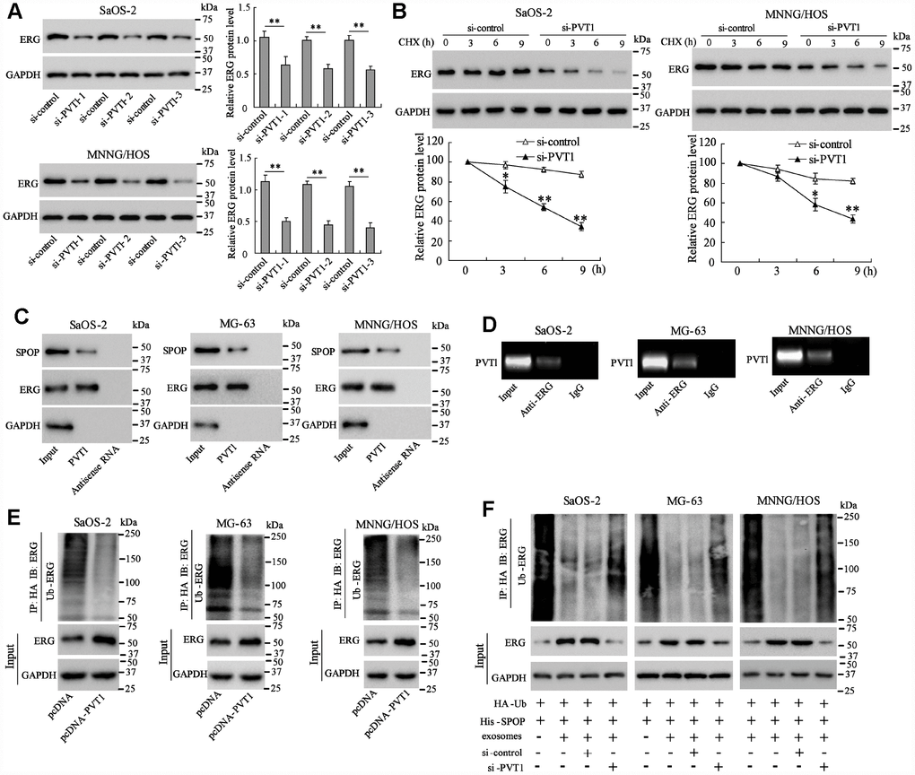 PVT1 in exosomes inhibits degradation and ubiquitination of ERG in osteosarcoma cells. Ssos-2 and MNNG/HOS cells were transfected with siRNA of PVT1 (si-PVT1) for 48 h. (A) The expression of ERG protein. (B) The degradation of ERG protein at 3, 6, and 9 hours after the treatment of the protein synthesis inhibitor, CHX (125 μg/mL). (C) The SPOP and ERG proteins were detected in PVT1-protein complex using RNA pull-down assay. Input was used as the positive control; antisense RNA was used as the negative control. (D) PVT1 was detected in ERG-RNA binding complex using RIP assay. Input was used as the positive control; IgG was used as the negative control. (E) Ubiquitination assay: Ssos-2, MG-63, and MNNG/HOS cells were transfected with pcDNA-PVT1, HA-Ub and His-SPOP for 24 h followed by the immunoprecipitation with HA antibody and immunoblotting with ERG antibody. (F) The ubiquitination assay was also performed in PVT1-interfering osteosarcoma cells after being co-cultured with BMSC-EXO. Three independent experiments. *p