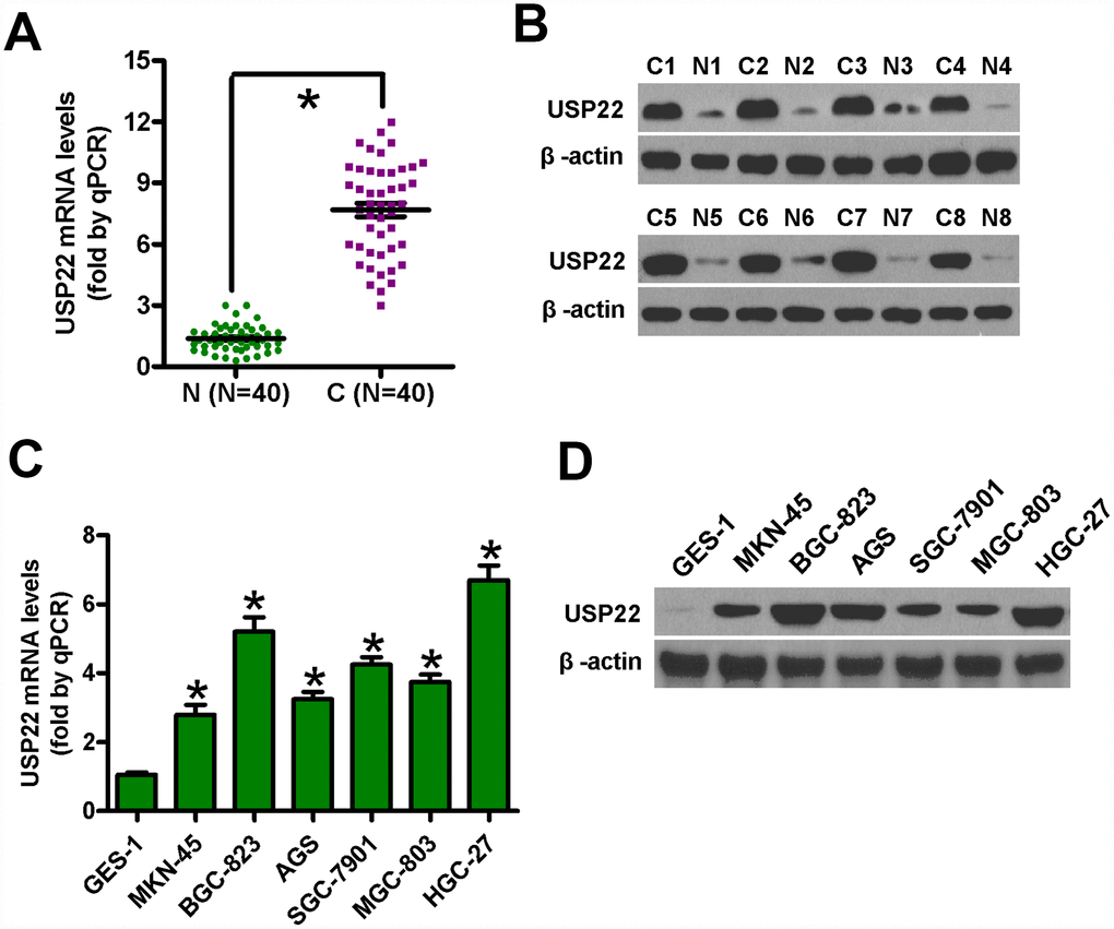 USP22 mRNA and protein levels in GC tissues and cell lines. (A) Histogram plots show USP22 mRNA levels based on qRT-PCR analysis in 40 pairs of GC (C) and adjacent noncancerous (N) tissues. GAPDH was used as an endogenous control. (B) Representative images show western blot analysis of USP22 protein levels in eight pairs of GC (C) and adjacent noncancerous tissues (N). β-actin was used as endogenous control. (C–D) The levels of USP22 mRNA (C) and protein (D) in GC cell lines and normal gastric mucosal epithelial cells are shown in the histogram plots and representative images, respectively. GAPDH and β-actin were used as the controls in the qRT-PCR and western blot analysis, respectively. Data are expressed as mean ± SD of three replicates. *p 