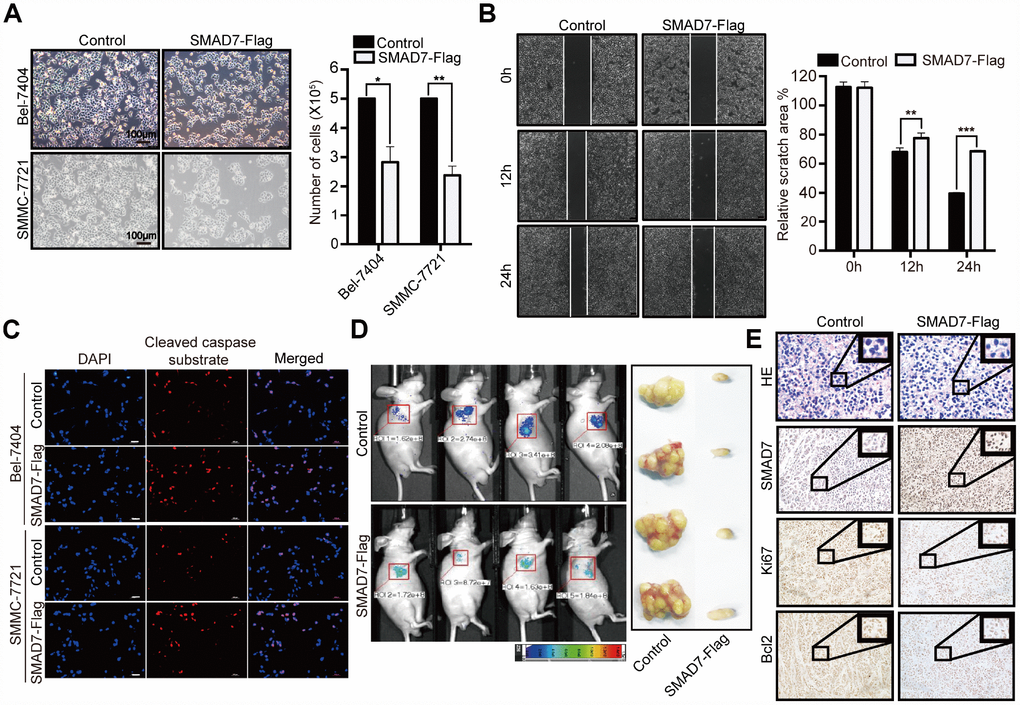 SMAD7 can inhibit liver cancer growth and migration. (A) The bright images of Bel-7404 and SMMC-7721 cells expressing GFP (Control) or SMAD7-Flag. Cells were plated at a density of 5,000 per well and imaged 7 days later (left panel). Scale bar: 100 μm. Cells were then quantified using ImageJ software and the relative cell number are shown as Mean ± SD from three independent tests (right panel). *pB) Bel-7404 cells were infected with control or SMAD7-Flag virus as indicated, and cell migration ability was assessed by cell scratch assay. The images are taken at the 0 h, 12 h and 24 h time points after the cultures were wounded by scratching (left panel). Quantification of relative scratch area is measured by ImageJ software, datas are showed as Mean ± SD of three independent experiments (right panel). **pC) SMAD7-Flag induced apoptosis marker cleaved caspase substrate expression measured by immunofluorescence assay in Bel-7404 and SMMC-7721 cells. Scale bars: 100 μm. (D) Representative images of control (expressing GFP tag) and SMAD7-Flag (expressing GFP tag) Xenografts mouse were analyzed by small animals in vivo imaging system (left panel) and representative images of tumor as indicated (right panel). (E) Representative HE and IHC images of SMAD7, proliferation marker Ki67 and apoptosis marker Bcl2 staining were taken in control and SMAD7-Flag Xenografts mouse tissue groups at 400Χ magnifications.