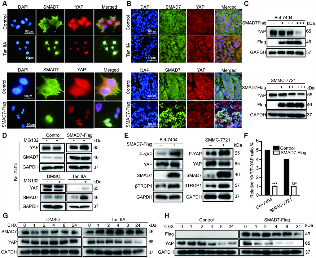 Tan IIA destabilized YAP through regulating SMAD7 in liver cancer. (A, B) Colocalization of SMAD7 and YAP in Bel-7404 cells and xenograft tissues analyzing by immunofluorescence assay. Scale bar: 50 μm. (C) Western blot assay analysis of SAMD7 and YAP protein expression in Bel-7404 and SMMC-7721 cells transfected with different dose SMAD7-Flag. (D) YAP and SMAD7 protein expression level were analyzed by western blot assay treated with or without MG132 in different groups. (E) P-YAP, YAP and βTrcp1 protein expression level were measured by western blot assay with or without SMAD7-Flag overexpression in Bel-7404 and SMMC-7721 cells. (F) Relative YAP/P-YAP ratio was measured by gray value. ***pG, H) Bel-7404 cells were stably transfected with or without SMAD7-Flag, with or without Tan IIA treated, and protein synthesis was blocked by treatment of CHX for the different time points. Relative SMAD7 and YAP protein levels were detected by western blot assay.