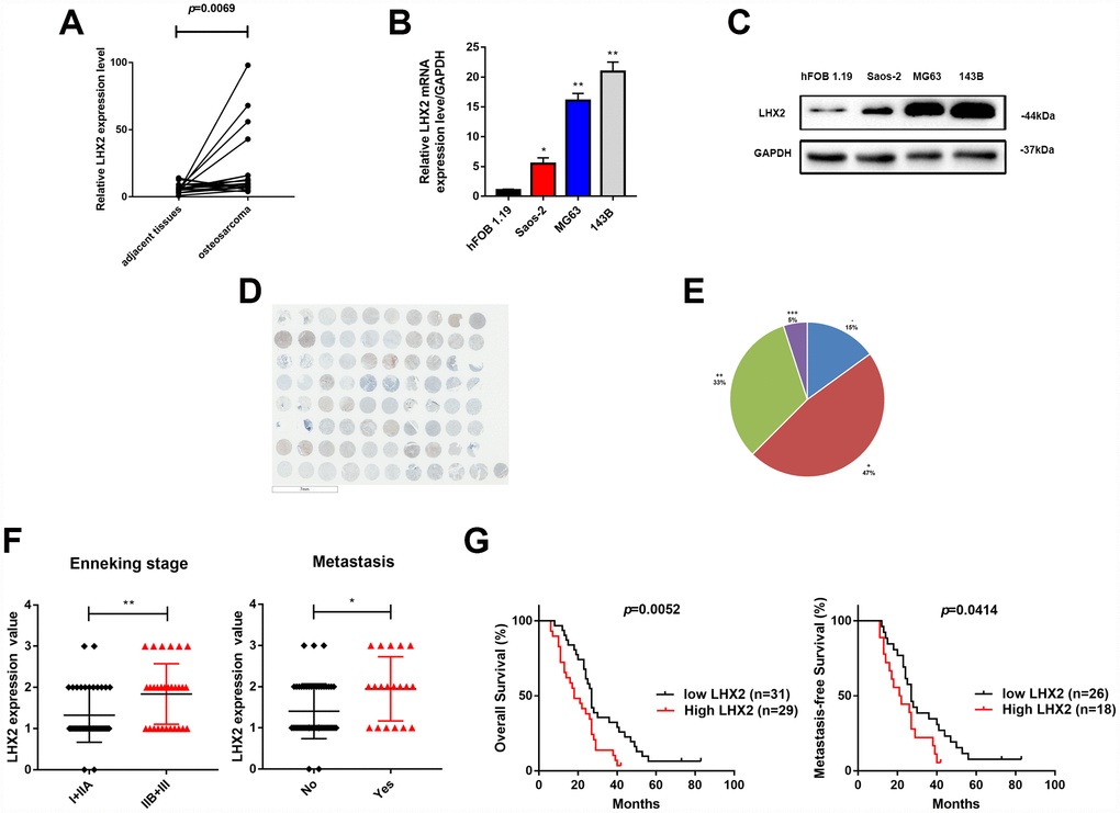 LHX2 is up-regulated in osteosarcoma and predicts poor prognosis. (A) Comparison of LHX2 expression in 18 paired OS and non-tumor tissues in the GEO database. **P B) LHX2 mRNA levels in OS cell lines. *P PC) LHX2 protein levels in OS cell lines. LHX2 expression is relative to GAPDH. (D) IHC staining of LHX2 in OS TMA (n=40, double dots per case). (E) Statistical analysis of IHC staining in human OS TMA (n=40). (F) Distribution of LHX2 IHC staining scores in OS tissues according to distant metastasis and Enneking stage classification. (G) Kaplan-Meier survival analysis according to LHX2 expression.