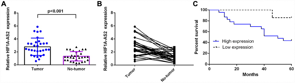 HIF1A-AS2 was upregulated in osteosarcoma and was related to poor survival. (A) The expression of HIF1A-AS2 in 30 osteosarcoma samples and their noncancerous pairs was detected by qRT-PCR. U6 was used as the internal control. (B) The expression of HIF1A-AS2 was upregulated in 23 cases (23/30; 77 %) compared to the expression in adjacent tissues. (Defined as a cutoff of Log 2.0-fold-change >1) (C) The high HIF1A-AS2 expression group had a shorter overall survival than the low HIF1A-AS2 expression group (median overall survival =50 vs. 92 months, respectively; log-rank p