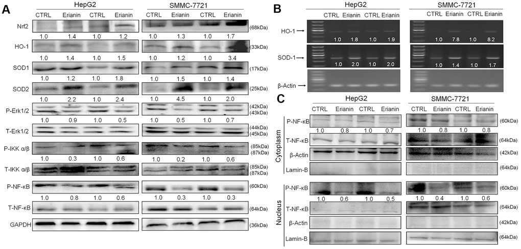 Effects of erianin on oxidative stress-mediated NF-κB pathway. (A) Erianin enhanced the levels of Nrf2, HO-1, SOD-1, and SOD-2, and reduced the phosphorylation levels of Erk1/2, IKKα/β, and NF-κB in spleens of BALB/c mice bearing HepG2- and SMMC-7721-xenografted tumors. Quantitative protein expression was normalized to GAPDH levels and/or related total protein levels in the corresponding samples. The marked average changes of proteins were expressed as folds relative to the corresponding control tumor tissues (n = 6). (B) Erianin enhanced the RNA levels of HO-1 and SOD-1 in spleens of BALB/c mice bearing HepG2- and SMMC-7721-xenografted tumors. Quantitative RNA expression data were normalized to the corresponding β-actin levels. The marked average changes of HO-1 and SOD-1 were expressed as folds relative to the corresponding control tumor tissues (n = 6). The molecular mass from top to bottom of the marker is: 1000, 700, 500, 400, 300, 200, 100 (bp). (C) Erianin reduced the phosphorylation levels of NF-κB in cytoplasm, and inhibited its transfer from cytoplasm to nucleus. The quantitative P-NF-κB expression in the cytoplasm and nucleus was normalized to the T- NF-κB levels, respectively. The marked average changes were expressed as folds relative to the corresponding control tumor tissues (n = 6).