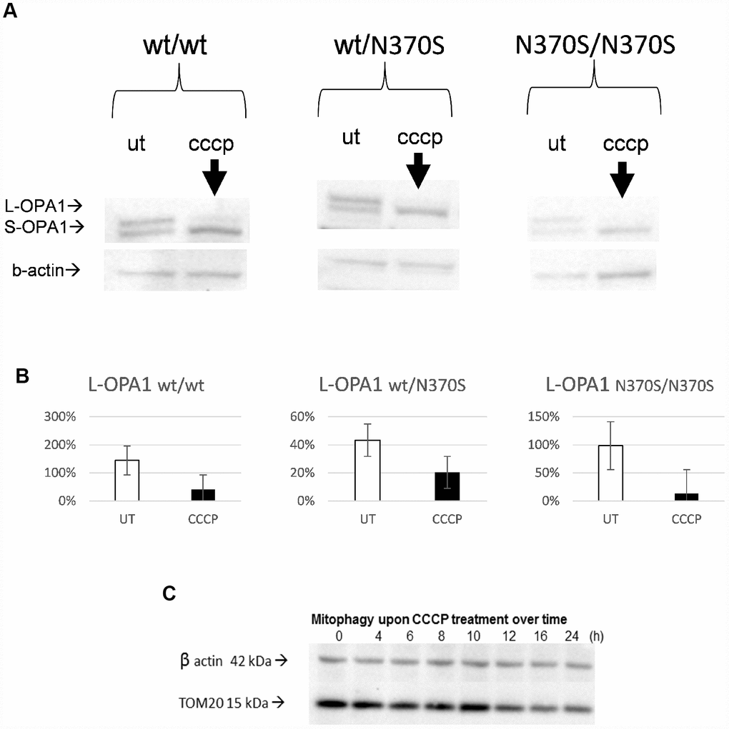 Confirmation of mitochondrial uncoupling with CCCP in the neurosphere model. Representative blots of OPA1 isoforms. Expected changes from long to short OPA1 isoforms were observed upon uncoupler treatment in all the genotypes, as mitochondria undergo depolarisation/fission following mitochondrial uncoupling (24h, 10 μM CCCP) (A and B). TOM20 levels progressively decrease from 0 to 24h in a control line (C). L-OPA1, long isoform of optic atrophy 1 protein OPA1; S-OPA1, short isoform of OPA1; UT, untreated.