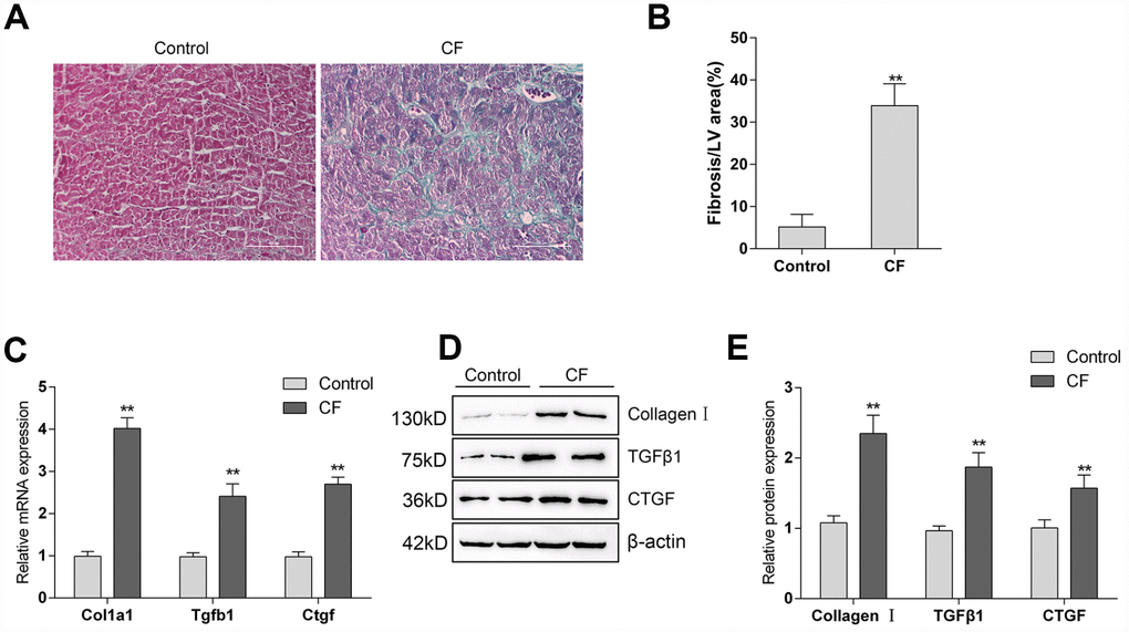 The construction and identification of ISP-induced cardiac fibrosis (CF) model in rats (A) Pathomorphological features of rat hearts in different groups examined by Masson staining. (B) In Masson staining, fibrotic tissue was stained to blue and myocardium to red. The fibrotic areas were calculated and the percentage of fibrotic tissue area was used to assess CF. (C–E) The mRNA expression and protein levels of Col1a1 (Collagen I), Tgfb1 (TGFβ1), and Ctgf (CTGF) in CF and control groups determined by real-time PCR and Immunoblotting analyses.