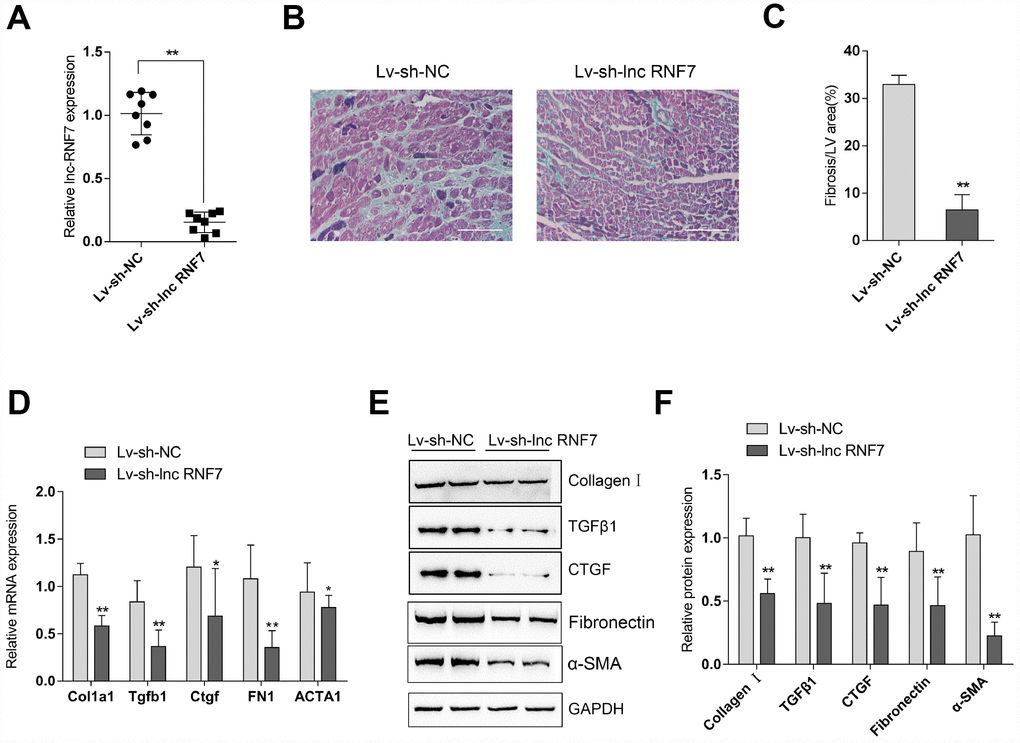 Effect of lnc RNF7 silence on CF rat (A) CF rats were injected with Lv-sh-lnc RNF7 or Lv-sh-NC and examined for the infection efficiency by real-time PCR. (B) Pathomorphological features of rat hearts in different groups examined by Masson staining. (C) The fibrotic areas were calculated and the percentage of fibrotic tissue area was used to assess CF. (D–F) The mRNA expression and protein levels of Col1a1 (Collagen I), Tgfb1 (TGFβ1), Ctgf (CTGF), FN1 (Fibronection), and ACTA1 (α-SMA) in CF and control groups determined by real-time PCR and Immunoblotting analyses.