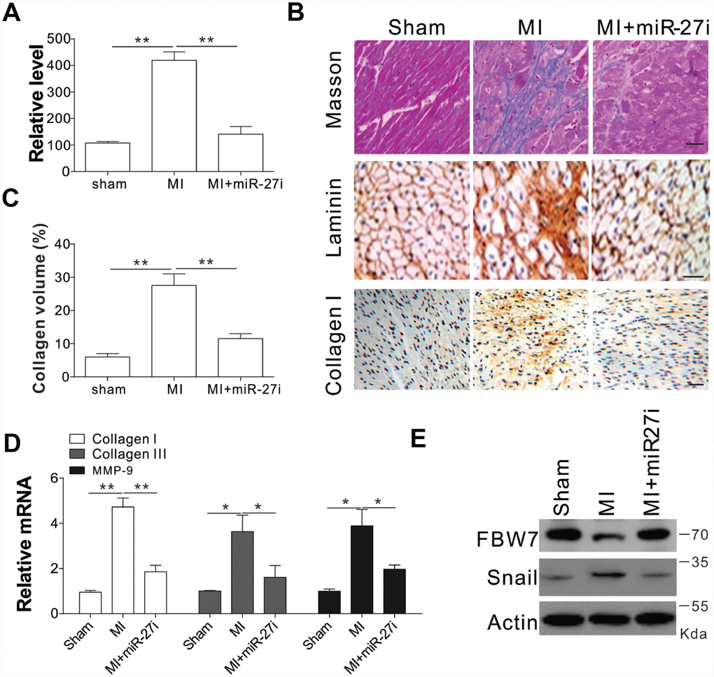 Antagomir-27b attenuated cardiac fibrosis in rat model of MI (A) Real-time PCR results of miR-27b levels in miR-27i or saline-treated specimens (3 weeks post-injection). (B, C) Analytical results of miR-27i-treated peri-infarct area of rat heart (3 weeks post-treatment). (B) Typical heart sections after treatments of Masson trichrome staining, laminin and collagen I immunostaining. Scale bar, 20 μm. (C) The percentage of tissue area represented the deposition of collagen I, where the automated image analyzer was used for its quantification. (D) Quantitative reverse transcription–PCR results of collagen I, collagen III, and MMP-9 mRNA levels. (E) FBW7 and Snail expression in rat heart. Data were represented as mean ± SEM (n=6). *, pp