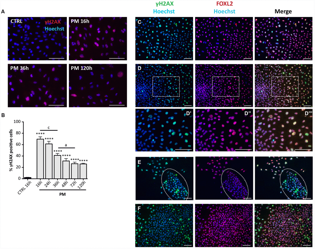 Analysis of PM-induced DNA damage in ovarian somatic cells. (A) Representative IF for γH2AX in somatic cells treated with PM. (B) The graph reports the quantification of γH2AX positive cells percentage. Data are shown as mean ± SEM of three experiments. Statistical differences vs control ****pvs CS 36 hrs c = pvs CS 72 hrs a = pC–F) Representative double IF for γH2AX (green) and FOXL2 (red) in (C) scattered fibroblastoid and epithelioid cells, (D) a large epithelioid colony (D’–D’’’ higher magnification images from D), (E) a little colony of small epithelioid cells (white circle) and (F) GCs from isolated secondary follicles after PM-treatment for 24 hrs. Scale bar = 100μm.