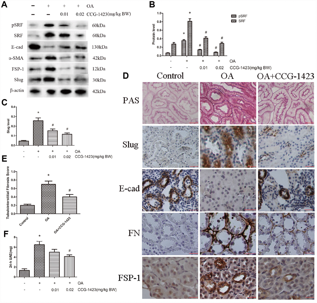 Inhibition of SRF improved the epithelial phenotype of TECs, renal tubulointerstitial fibrosis and albuminuria in vivo. (A–C) Protein expression levels of pSRF, SRF, E-cadherin, α-SMA, FSP-1 and slug measured by western blot and quantitative analyses. (D) Renal tubulointerstitial fibrosis in the three groups measured by PAS staining. Immunohistochemical staining for slug, E-cadherin, FN and FSP-1 in the three groups. (E) Tubulointerstitial fibrosis scores of the three groups. (F) Dose-dependent reduction in 24-h UAE in HN rats induced by CCG-1423 treatment. Bar=25 μm. N=6 in each group. *P#P