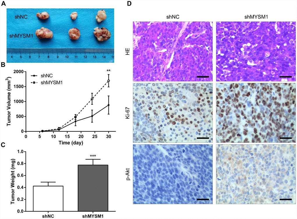 Downregulation of MYSM1 facilitates prostate cancer growth in vivo. (A) Representative image of tumors formed in nude mice bearing 22Rv1/shNC or 22Rv1/shMYSM1 cells. (B) The volumes of tumors derived from nude mice subcutaneously implanted with 22Rv1/shNC or 22Rv1/shMYSM1 cells were monitored for 30 days. Data are shown as mean ± SD of 3 replicates. (C) The animals were sacrificed 30 days after injection and tumor weights were evaluated. Data are shown as mean ± SD of 3 replicates. (D) Representative photographs of IHC staining of p-Akt and Ki-67 in tumor tissues from 22Rv1/shNC and 22Rv1/shMYSM1 nude mice groups. Scale bars are 30 μm. ** P 