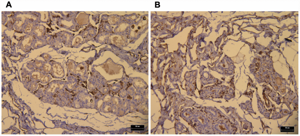 IHC of normal a mammary gland (NMG) showing both Col1 (A) and Col 3 (B) basal expression levels (brown dots). Bars, 50 μm.