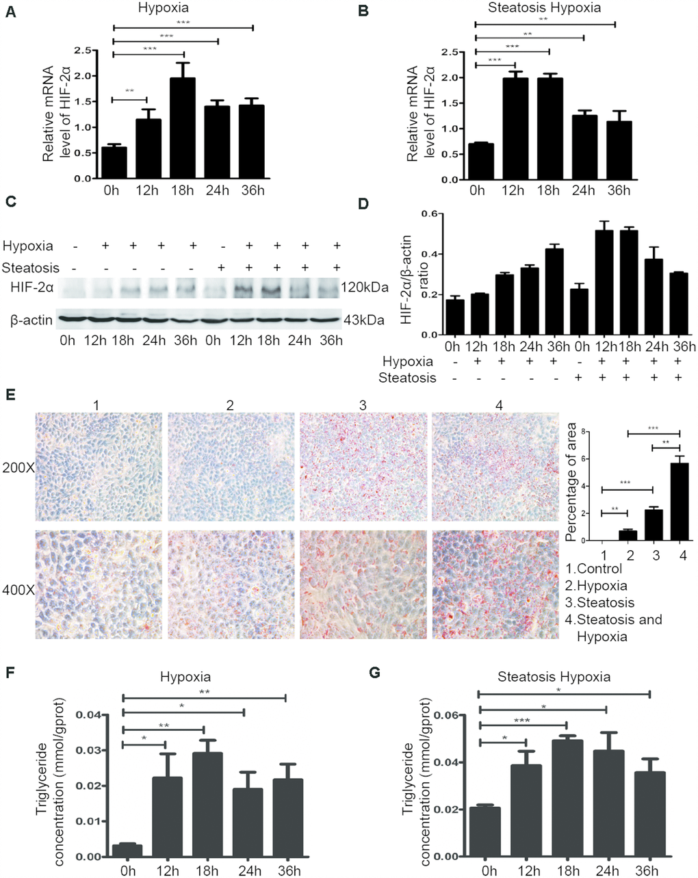 The hypoxic microenvironment induces lipid accumulation in HCC and steatotic HCC cells by upregulating HIF-2α. (A, B) Quantitative RT-PCR assessment of HIF-2α expression in HCC and steatotic HCC cells under hypoxic conditions. Transcription levels were normalized to those of β-actin. (C) Western blot analysis of HIF-2α expression in HCC and steatotic HCC cells under hypoxic conditions. β-Actin was used as the loading control. (D) Densitometric analyses of the band intensity ratios for HIF-2α/β-actin. (E) Oil red O staining and quantification in HCC and steatotic HCC cells with or without hypoxia treatment. (F, G) Triglyceride levels in HCC and steatotic HCC cells subjected to different durations of hypoxia.