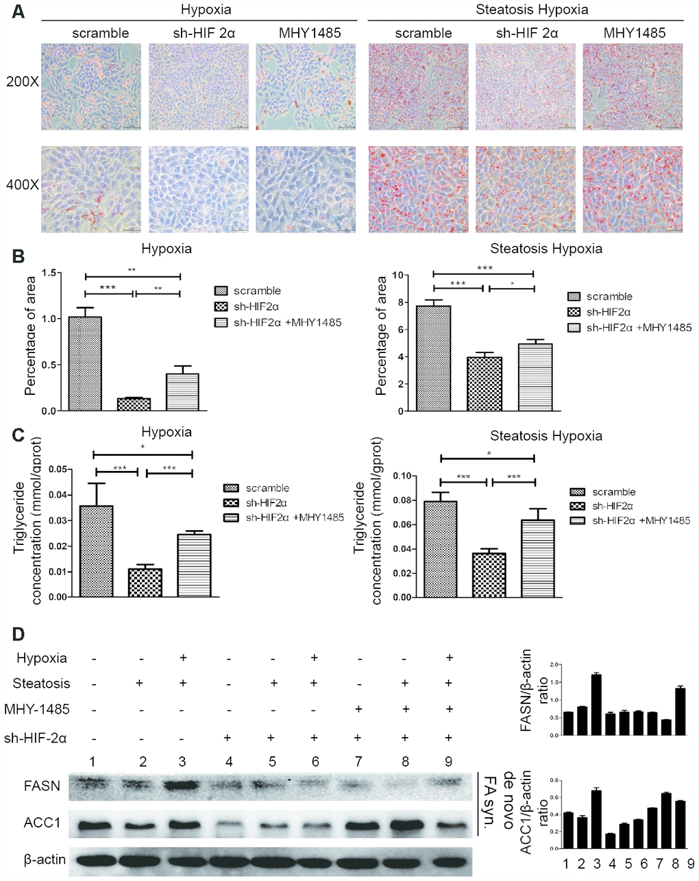 HIF-2α induces steatotic HCC lipid synthesis under a hypoxic microenvironment (A) Oil red O staining and quantification in HCC and steatotic HCC under hypoxic conditions in the presence or absence of MHY1485. (B, C) Triglyceride levels in HCC and steatotic HCC under hypoxic conditions in the presence or absence of MHY1485. (D) Western blot analysis of lipid synthesis-related proteins in HCC and steatotic HCC under hypoxic conditions. Densitometric analyses of the band intensity ratios for ACC1/β-actin and FASN/β-actin.