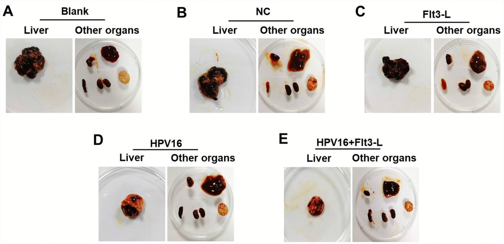 The nucleic acid vaccine inhibited hepatic metastasis in vivo. (A–F) Mice (n=25, five mice/group) in the blank, pVAX1-IRES, pVAX1-IRES-FLT3L, pVAX1-IRES-GM-CSF-B7.1-HPV16 E6/E7 and pVAX1-IRES-GM-CSF-B7.1-HPV16 E6/E7-FLT3L groups were injected with HPV16 E6/E7+Luc stable cells. After four weeks, they were sacrificed for the observation of tumor metastasis to other organs (heart, liver, spleen, lung, kidney and brain tissues).