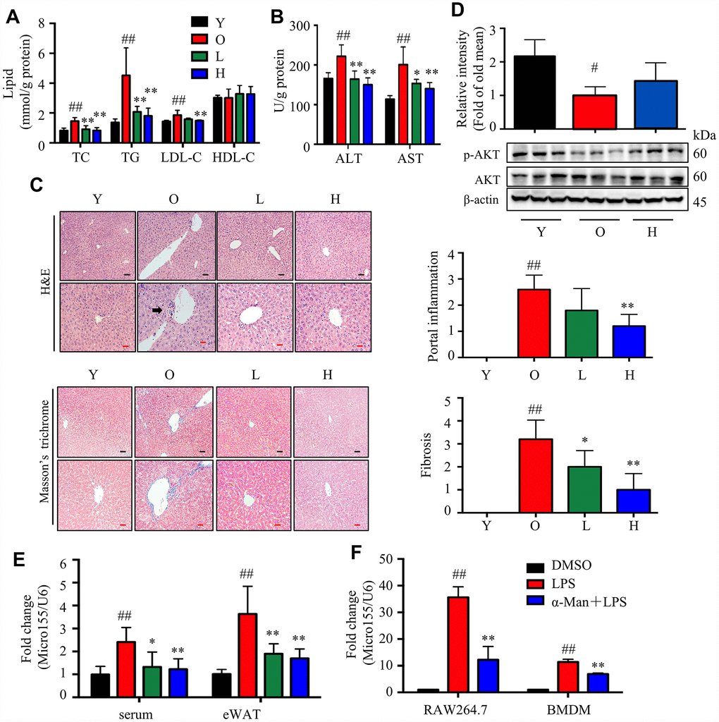 α-Man alleviates liver injury in old mice by inhibiting miR155 expression. (A) The levels of TC, TG, LDL-C and HDL-C in livers (n = 5). (B) The levels of ALT and AST in livers (n = 5). (C) H&E staining and Masson’s trichrome staining of liver tissues, and histopathological scores of individual livers on portal inflammation and fibrosis. (n = 5). Black scale bar = 100 μm, red scale bar = 50 μm. Black arrows indicate sites of portal inflammation. 0 = no significant change, 1 = minimal, 2 = mild, 3 = moderate, and 4 = severe pathology. (D) The levels of p-AKT and AKT were detected by Western blot (n = 5). β-Actin was used as an internal loading control. (E) The expression level of miR-155 in the serum and eWAT from mice (n = 5). Data were normalized to level of U6 snRNA. Data are expressed as means ± SD. #P ##P P P F) The expression level of miR-155 in LPS stimulated RAW264.7 macrophages and BMDMs (n = 6). Data were normalized to level of U6 snRNA. Data are expressed as means ± SD. ##P P 