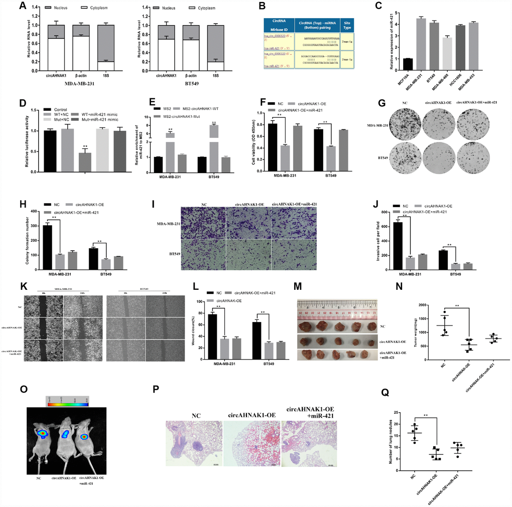 circAHNAK1 can act as a sponge for miR-421. (A) The expression levels of nuclear control (18S), cytoplasmic control (β-actin) and circAHNAK1 were detected; (B) Prediction of the binding site of miR-421 in the circAHNAK1 sequence; (C) The expression of miR-421 in TNBC cell line; (D) Luciferase assay of cells co-transfected with the miR-421 mimics and the circ-AHNAK1 wild type or mutant luciferase reporter; (E) GFP-MS2-RIP assay detects enrichment of miR-421after MS2bs-circAHNAK1-WT, MS2bs-circAHNAK1-Mut or control transfection, respectively; (F) Effect of miR-421 mimics transfection on proliferation of circAHNAK1 overexpressing cells by CCK-8; (G) Effect of miR-421 mimics transfection on circAHNAK1 overexpressing cells by clone formation assay; (H) Quantitative clone formation by ImageJ software; (I) Transwell invasion assay assessed the impact on cell invasion;(J) ImageJ software quantifies the number of invading cells;(K)Wound healing assay for detecting changes in cell migration ability; (L) ImageJ software quantifies the extent of wound closure; (M) Xenograft model to evaluate tumor proliferation in vivo; (N) Comparison of tumor weight; (O)Representative images of luciferase signaling of lung metastasis in vivo; (P) Representative images of HE staining of lung metastatic nodule sections; (Q) Quantification of the number of lung metastatic nodules.