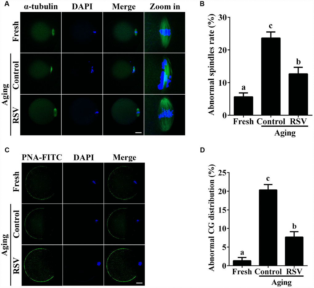 RSV maintains the spindle morphology and affects the CG distribution. (A) Spindles were imaged using anti-α-tubulin (green), and the chromosomes were counterstained with DAPI (blue). Bar = 200 μm. (B) Statistical analysis of abnormal spindle rate in (A). (C) CGs were imaged using anti-PNA (green), and the chromosomes were counterstained with DAPI. Bar = 200 μm. (D) Quantitative analysis of abnormal CG distribution in (C). Data are presented as means ± S.E.M of three independent experiments. Different lowercase letters represent the difference of expression levels that are significant (P 