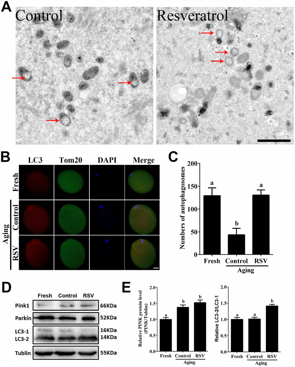 RSV promotes mitophagy in aged oocytes. (A) Electron microscopy results showed the effect of RSV on mitochondrial morphology. Bar = 1 μm. (B) With the treatment of RSV, the autophagy level was detected by counterstaining with LC3 (red), Tom20 (green) and DAPI (blue). Bar = 50 μm. (C) Quantitative analysis of autophagosome numbers in (B). (D) After RSV treatment, the LC3 (including LC3-1 and LC3-2), PINK and Parkin protein expressions were measured by western blot. α-Tubulin was used as a loading control. (E) Quantitative analysis of protein level of PINK1 in (D) and the relative LC3-2/1 level was calculated. Data are presented as means ± S.E.M of three independent experiments. Different lowercase letters represent the difference of expression levels that are significant (P 