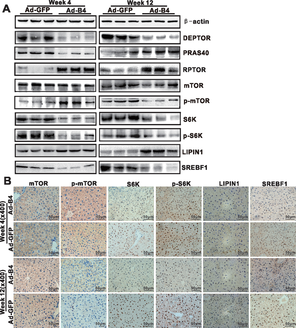 BMP4 down-regulates the mTORC1 signaling pathway in mouse liver. The liver samples prepared in Figure 3 were used for the following assays. (A) Total cell lysate was prepared from the retrieved liver samples and subjected to Western blotting analysis of the expression of the members of mTORC1 signaling pathway. (B) The retrieved liver samples were paraffin-embedded, sectioned and subjected to IHC staining to detect the expression of the members of mTORC1 signaling pathway and lipid metabolism. Each assay condition was done in triplicate, and representative images are shown.