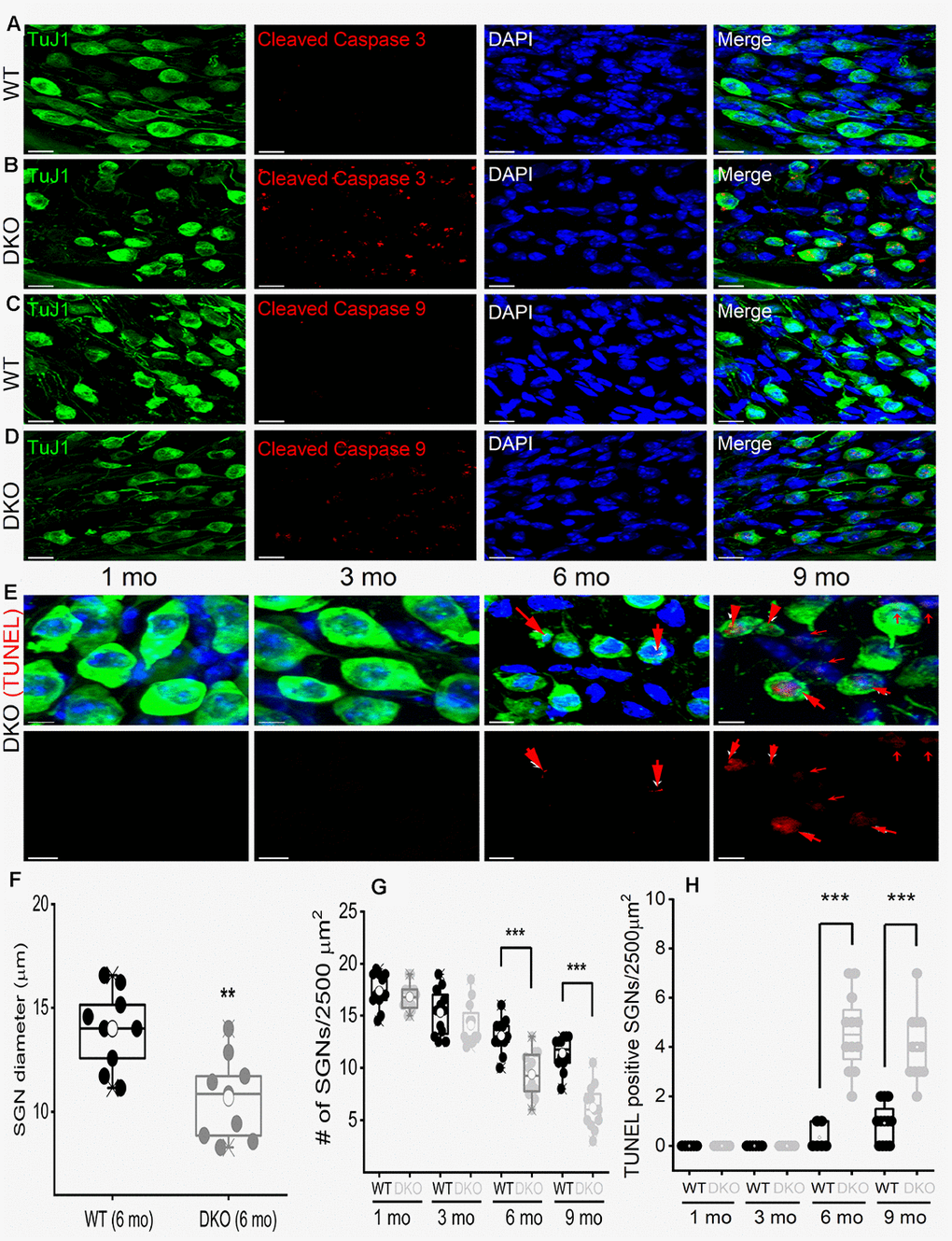 Age-related degeneration of SGN through apoptosis signal. (A–D) Immunofluorescence detection of cleaved caspase 3 (red; A–B) and caspase 9 (red; C, D) in WT and DKO 5-mo old cochlear sections. SGNs were labeled with neuronal marker TuJ1 (green). The nuclei were stained with DAPI (blue). Scale bar: 20 μm. Increased active caspase 3/9 was seen in DKO cochlear sections. Scale bar = 10 μm. (E) Shown are cochlear sections of in DKO cochleae at difference ages (1-9 mos) assessed for with TUNEL assay (TUNEL-positive in red). Scale bar: 5 μm. (F) Summary histogram showing a significant reduction in SGN size (diameter) between WT and DKO mice at 6-mo old (data from 9 mice each). (G) Age-dependent (1-9 mo) reduction in SGN densities (data from 8-9 mice each). Comparison between WT and DKO mice. (H) Summary data from WT and DKO cochleae at ages indicated, showing increased TUNEL-positive SGNs in 6-9–mo old (data from 8-9 mice each). Significant differences between genotypes were determined using unpaired two-tailed t-test (* p 