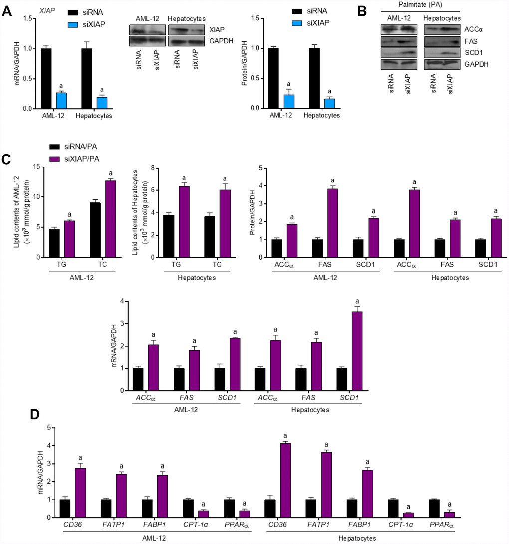 XIAP silence enhances dyslipidemia in PA-treated cells in vitro. (A) AML-12 and primary hepatocytes were transfected with XIAP specific siRNA sequence for 24 h, followed by transfection efficacy calculation using qPCR and western blot analysis. AML-12 and primary hepatocytes were subjected to XIAP siRNA transfection for 24 h, and then cells were incubated with 250 μM of PA for additional 24 h, followed by further investigation. (B) Representative western blot and qPCR analysis of the expression of ACCα, FAS and SCD1 in PA-induced hepatocytes and AML-12 cell line. (C) Determination of cellular TG and TC levels in AML-12 and hepatocytes was next detected. (D) qPCR analysis for genes associated with fatty acid metabolism, including CD36, FATP1, FABP1, CPT-1α and PPARα, in cells treated as indicated. For all bar plots shown, data are expressed as the mean ± SEM. n = 8 per group. ap 