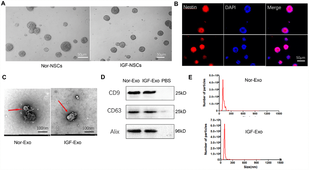 Characteristics of neural stem cells (NSCs) and exosomes derived from NSCs. (A) Morphology of neurospheres with typical shape examined by light microscopy. (B) Nestin immunofluorescence (red), a marker of NSCs, in neurospheres. (C) Exosome morphology examined by transmission electron microscopy. (D) Western blot analysis of exosome surface markers. (E) Particle size distribution of Nor-Exo and IGF-Exo by Nano Sight.