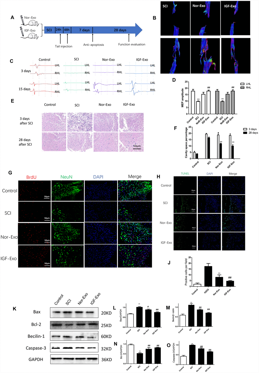 IGF-Exo inhibited neural apoptosis and neuroinflammation after SCI invivo. (A) Schematic of tail intravenous injections of Nor-Exo and IGF-Exo in SCI model rats. (B) DTIs constructed for the SCI, Nor-Exo, and IGF-Exo groups at 1 day and 28 days after surgery. (C) Neuroelectrophysiological examination results for each experimental group (control, SCI, Nor-Exo, and IGF-Exo) at 3 days and 28 days after surgery. (D) MEP amplitudes for each experimental group at 3 days and 28 days after surgery. (E) Hematoxylin-Eosin staining of sections containing SCI lesions in each experimental group at 3 days and 28 days after surgery. (F) Cavity space percentages for each experiment group at 3 days and 28 days after surgery. (G) BrdU and NeuN immunofluorescence indicative of neuron regeneration in each experimental group at 28 days after surgery. (H) TUNEL staining (green) indicative of apoptosis after SCI in each experimental group; DAPI in blue. (J) Numbers of TUNEL-positive cells per field for each experimental group. (K–O) Western Blot analysis of pro- and anti-apoptotic proteins (BAX, Bcl-2, Beclin-1, and Caspase-3). Data are expressed as means ± SD (analysis of variance followed by Student-Newman-Keuls posthoc test). **P vs. control group; ##P vs. SCI group.