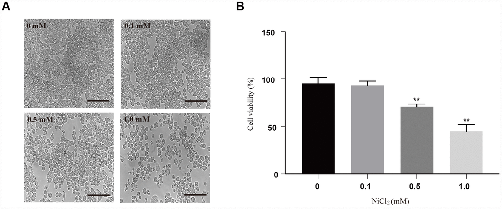 Cytotoxicity of NiCl2 in BMDMs. (A) BMDMs are treated with NiCl2 (0, 0.1, 0.5 and 1.0 mM) for 24h, and changes of cell numbers were observed by microscopy. Scale bar 50 μm. (B) Cell viability is analyzed by MTT assay. Data are presented with the means ± standard deviation (n=5). *p 