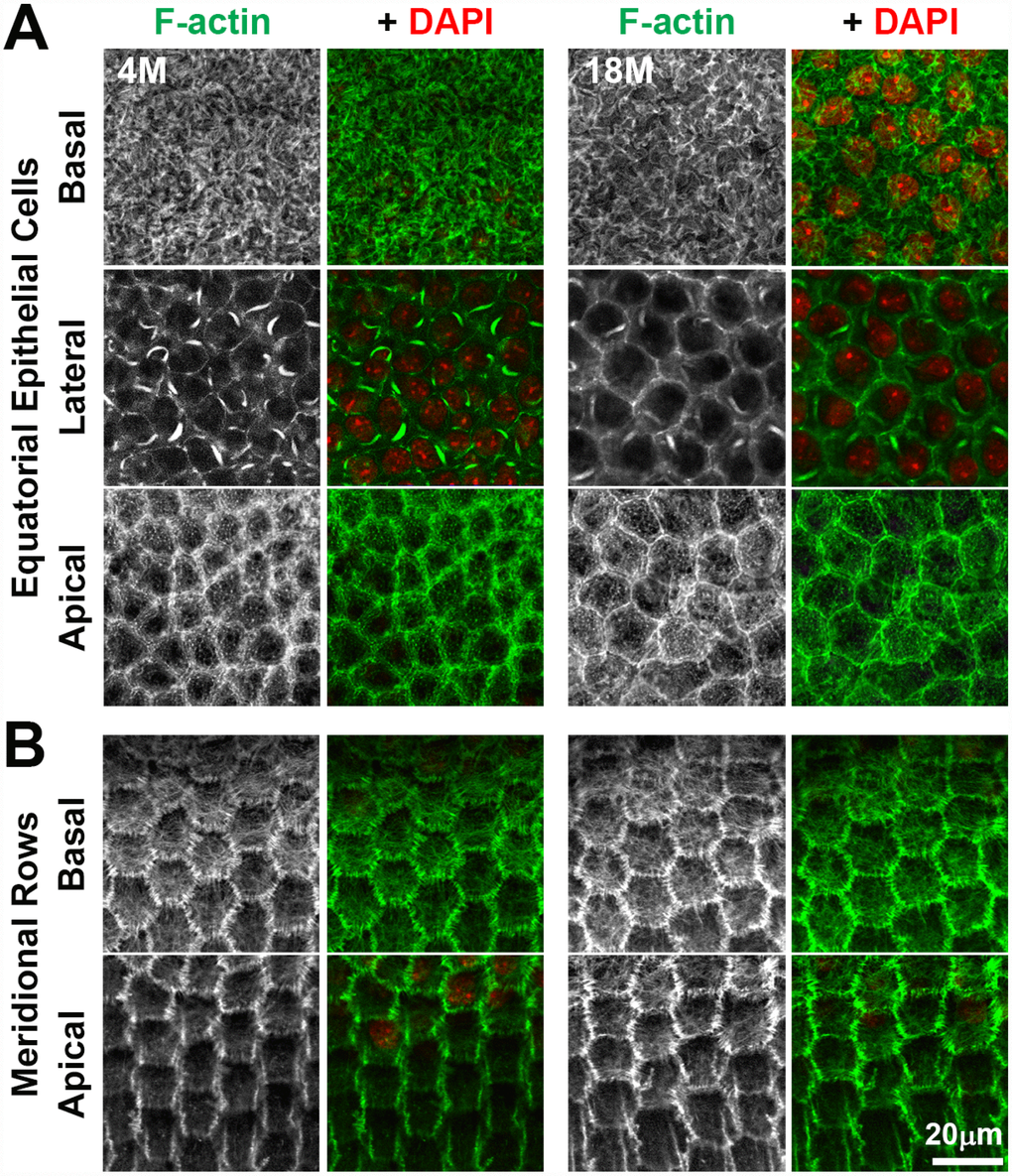 Whole lens staining for F-actin (phalloidin, green) and nuclei (DAPI, red) in 4-month-old and 18-month-old lenses reveal that the actin cytoskeleton in epithelial cells and the formation of organized meridional rows of hexagonal equatorial epithelial cells is similar between 4-month-old and 18-month-old lenses. (A) Single XY planes through anterior epithelial cells show similar F-actin staining and organization of equatorial epithelial cells between 4-month-old and 18-month-old lenses. These cells have a network of basal F-actin, membrane-adjacent F-actin and sequestered actin bundles near the lateral membrane, and polygonal arrays on the apical surface. (B) Single XY planes through the meridional rows at the lens equator reveals organized hexagonally-shaped epithelial cells with normal membrane-adjacent F-actin networks and a basal meshwork of F-actin in the 4-month-old and 18-month-old lenses. These data reveal that fiber cell shape changes and disorganization in older lenses is not due to altered shape or misalignment of equatorial epithelial cells. Scale bar, 20μm.