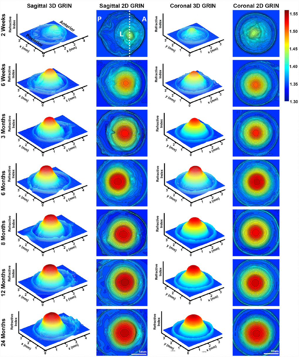 3D mesh and 2D contour plots of the gradient of refractive index (GRIN) in whole eyes from mice between 2 weeks to 24 months of age. Plots are through the mid-sagittal plane and the mid-coronal plane passing through each central lens nucleus. The anterior of the eye (A), the posterior of the eye (P) and the lens (L) are marked on the mid-sagittal views of the 2-week-old eye. The dotted line through the 2D sagittal view of the 2-week-old eye represents the location of the mid-coronal 3D and 2D heat maps. All images are oriented in the same direction. Colors reflect the magnitude of refractive index from low refractive index in dark blue (1.30) to high refractive index in dark red (1.55). The areas with highest refractive index are the lens. Mouse lens GRIN profiles are two-tiered with a ring of indentation (bright yellow) clearly seen in the 3D mesh plots. There is a cap region of high refractive index (red and orange) and a bottom region (yellow and green). There is an increase in the size of the cap region with age. These data show that GRIN in mouse lens develops by 2 weeks of age, and there is a rapid increase and plateau of maximum refractive index at the center of the lens with age.