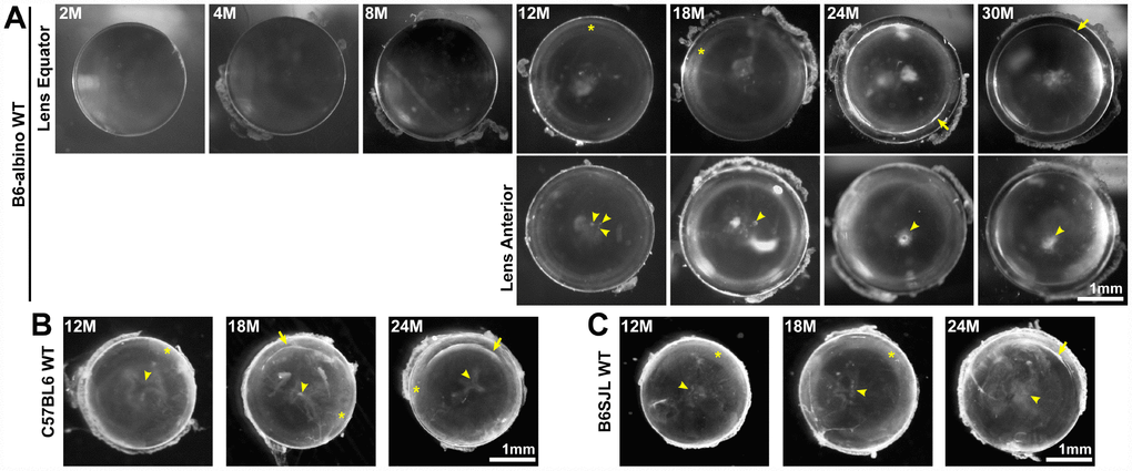 Lens images (top down view) from mice between 2-30 months of age in various B6 wild-type backgrounds. (A) B6-albino wild-type mice have clear lenses up to 8 months of age and develop small anterior opacities (arrowheads) by 12 months of age. Lenses from mice between 12-18 months develop cortical haziness (asterisks). Old lenses from mice between 24-30 months display ring cataracts (arrows) with a clear periphery and translucent, but not transparent, central regions. (B, C) Similar to B6-albino wild-type lenses, C57BL6 and B6SJL wild-type lenses also develop anterior opacities (arrowheads), cortical haziness (asterisks) and ring cataracts (arrows) at the same age as B6-albino wild-type mice. These images reveal that aged mouse lenses in the B6 genetic background develop cataracts around 12 months of age at the anterior pole and the lens cortex (haziness and ring opacity). Scale bars, 1mm.