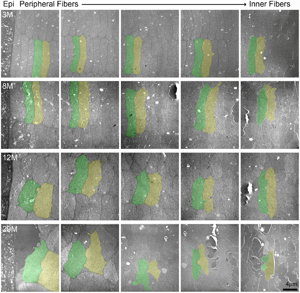 Transmission electron microscopy (TEM) of lens cross sections at various depths in 3–29-month-old lenses. Two neighboring cells in each panel are pseudo-colored green and yellow to show cell shape and size. In the 3- and 8-month-old lenses, fiber cells are hexagonal in shape and uniform in size from the periphery to the inner mature fiber cells. In the 12-month-old lens, the most peripheral fibers have lost their distinct hexagonal shape, but cells are still similarly sized between neighboring layers. In the 29-month-old lens, the cells have lost their characteristic hexagon cell shape and are highly variable in shape and size. There is also variability in electron density between neighboring cells in the 29-month-old lens with dark and light gray cells. Scale bar, 4μm.