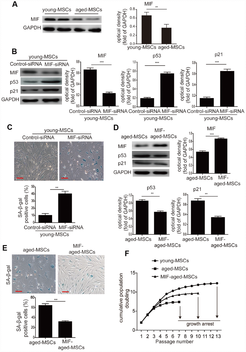 MIF inhibited the cellular senescence of MSCs. (A) Western blotting and quantitative analysis of MIF protein expression in young and aged MSCs. (B) Western blotting and quantitative analysis of MIF, p53 and p21 protein expression in young MSCs treated with control siRNA or MIF-siRNA. (C) Representative images of SA-β-gal staining and quantitative analysis of SA-β-gal-positive cells in young MSCs treated with control siRNA or MIF-siRNA. (D) Western blotting and quantitative analysis of MIF, p53 and p21 protein expression in aged and MIF-aged MSCs. (E) Representative images of SA-β-gal staining and quantitative analysis of SA-β-gal-positive cells in aged and MIF-aged MSCs. (F) Cell growth curves showed that overexpression of MIF in aged MSCs increased their growth rate. Scale bar=100 μm. Data are expressed as the mean±SEM. n=3. **p