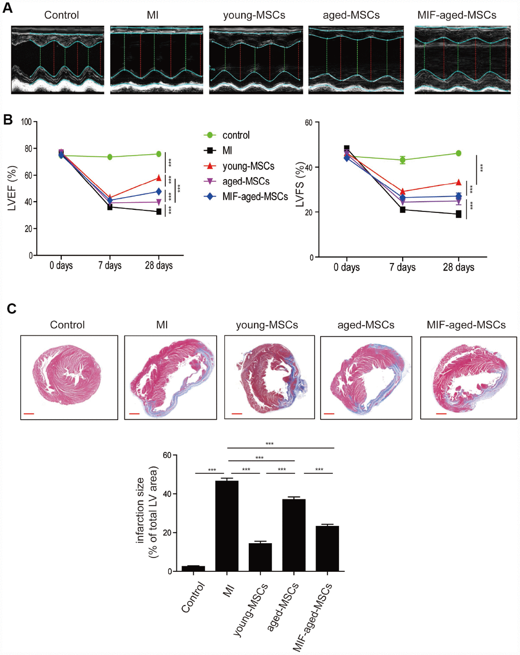 Transplantation of MIF-aged MSCs improved cardiac function in a rat model of MI. (A) Representative images of M-mode echocardiography captured 28 days after MI in rats from the different groups. (B) Heart function, including the LVEF and LVFS, was evaluated at 0, 7 and 28 days in control mice and MI mice with or without MSC transplantation. (C) Representative images of Masson's Trichrome staining and quantitative analysis of heart fibrosis in the different experimental groups. Scale bar=2 mm. Data are expressed as the mean±SEM. n=6-7. **p