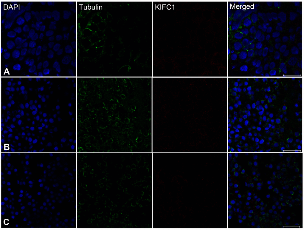 Effects of kifc1 knockdown on the distribution and assembly of the microtubules in the testis, vas deferens and spermatosphore. (A) The microtubules in the testis. (B) The microtubules in vas deferens. (C) The microtubules in spermatosphore. When kifc1 was knockdown, the microtubules were low expressed and abnormally assembled in spermatogonia and spermatocyte, while no obvious difference was found in spermatid from the vas deferens and mature sperm from spermatosphore. Blue: DAPI, Green: tubulin, Red: KIFC1. Scale bar = 20μm.