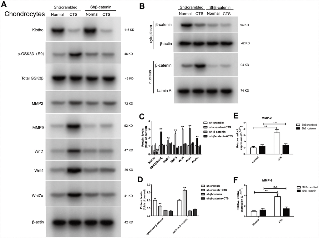 Expression of Klotho, Wnt1, Wnt4, Wnt7a in the cell supernatant and GSK3β, p-GSK3β, MMP2, MMP9, MMP-7, β-catenin (cytoplasm/nucleus) in the cell of chondrocytes knockdown of β-catenin. (A) The protein expression detection of Klotho, Wnt1, Wnt4, Wnt7a in the cell supernatant and Phos-GSK3β (S9), GSK3β, MMP2, MMP9, and (B) β-catenin (cytoplasm/nucleus) by Western Bolt, quantitative data (C) is presented. *P,0.05 versus controls (n=3), (E, F) RT-PCR was used to detect the expression of MMP-2 and MMP-9 mRNA in different groups. Results were obtained via the expression of three individual experiments performed in triplicate for each condition. *P 