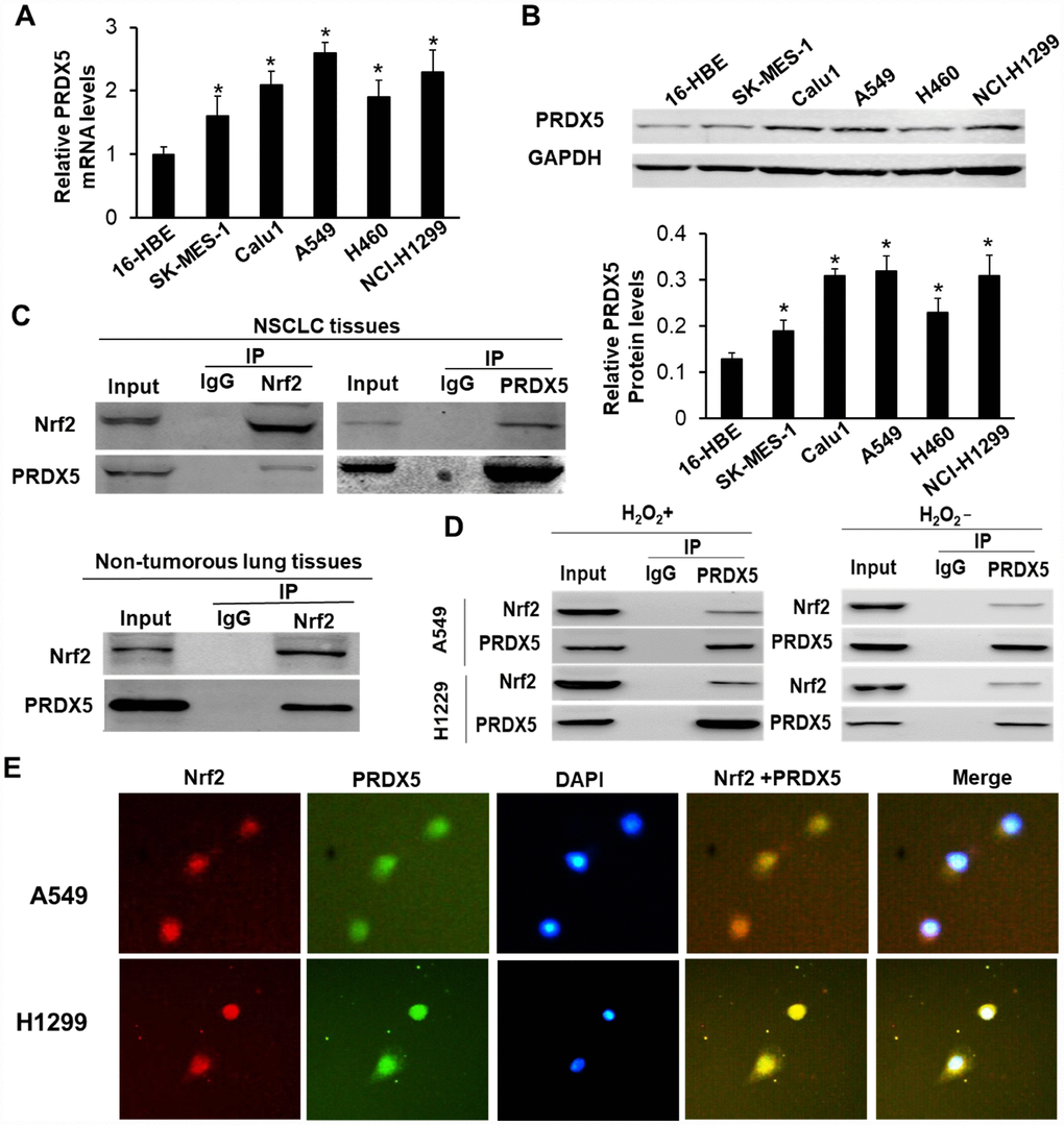 PRDX5 interacted with Nrf2 in NSCLC tissues and related cell lines. (A) qRT-PCR analysis of PRDX5 mRNA level in NSCLC cell lines and 16-HBE cells. The data are reported as the mean ± SD. *P B) PRDX5 proteins in the different NSCLC cell lines and the normal bronchial epithelial cell 16-HBE analyzed by Western blot analysis. The data shown represent the mean ± SD (*P C) Reciprocal immunoprecipitation of Nrf2 and PRDX5 in human NSCLC tissue (figure above) and PRDX5 was immunoprecipitated using an anti-Nrf2 antibody in the adjacent normal tissue (figure below). Lysates of the tissues were immunoprecipitated with anti-Nrf2, anti-PRDX5 antibodies or control IgG. The immunoprecipitates were subjected to Western blot analysis with anti-PRDX5 and anti-Nrf2 antibodies. (D) Interaction between Nrf2 and PRDX5 in A549 and NCI-H1299 cells under H2O2 treatment or nontreatment. The lysates obtained from the cells treated with 100 μM H2O2 for 30 min or not were immunoprecipitated using anti-Nrf2, anti-PRDX5 antibodies or control IgG. (E) Immunofluorescence analysis of Nrf2 and PRDX5 in A549 and NCI-H1299 cells. A549 and H1299 cells were pre-incubated with 100 μM H2O2 for 30 min, and then immunostained with a combination of anti-Nrf2 and anti-PRDX5 antibodies. The fluorescent images were digitally merged. Yellow coloration in overlay panels indicates colocalization of Nrf2 and PRDX5. Nuclei were counterstained with DAPI. Scale bar, 50 μm.