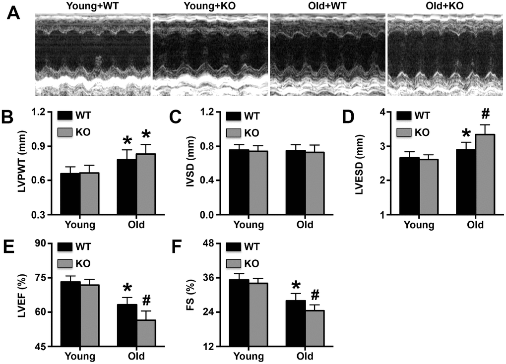 Effects of IL-12p35 KO on cardiac function. (A). Representative M-mode echocardiograms, (B). LVPWT, (C). IVSD, (D). LVESD, (E). LVEF and (F). FS for each group. * p# p