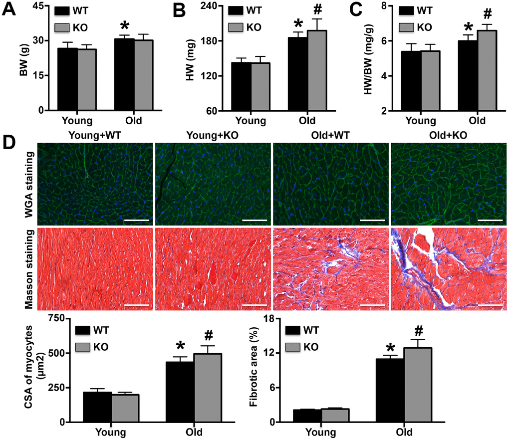 Regulatory role of IL-12p35 KO in cardiac remodeling. (A–C). Body weights (BW), heart weights (HW) and HW/BW ratios were measured in the four groups; n=10 for each group. (D). The cross-sectional areas (CSA) of cardiomyocytes and cardiac fibrotic areas were measured by WGA staining and Masson staining, respectively (200x). * p# p