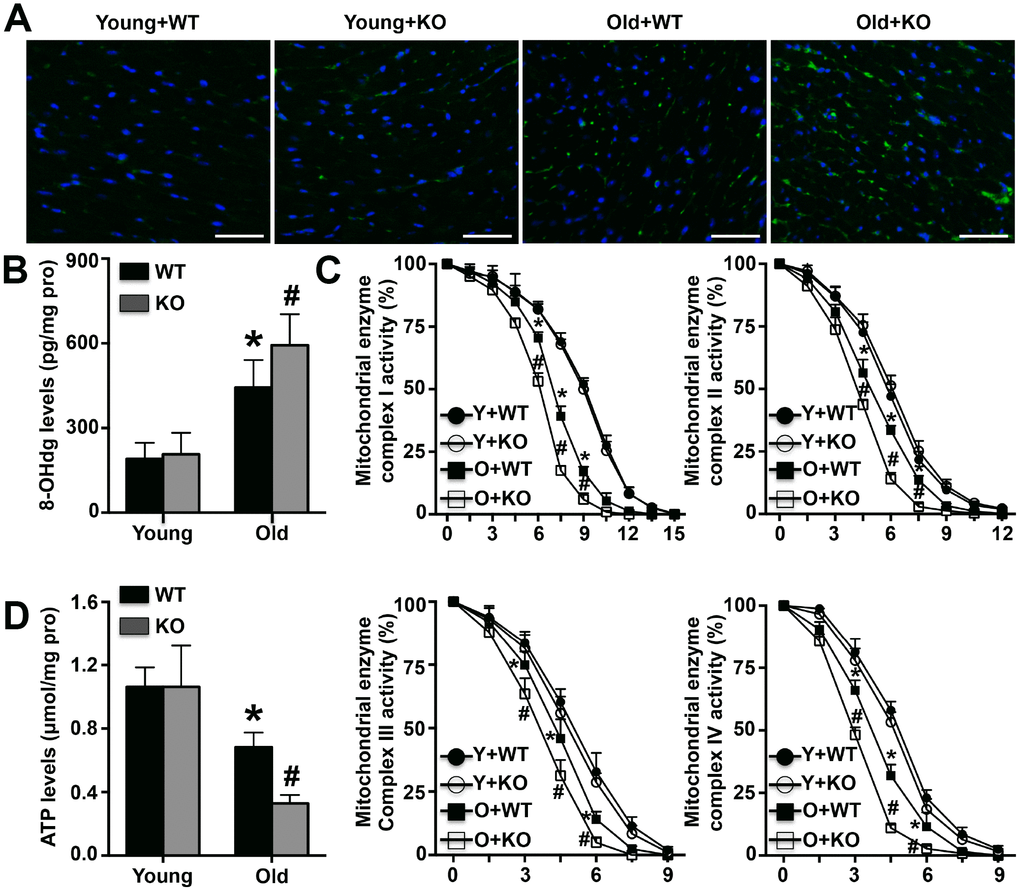 Effects of IL-12p35 KO on mitochondrial dysfunction. (A, B). Cardiac 8-OHdg expression (200x) and mitochondrial 8-OHdg levels were detected. (C). The activity of mitochondrial enzyme complexes I, II, III and IV in the four groups was measured. (D). The mitochondrial ATP levels in each group were detected. * p# p