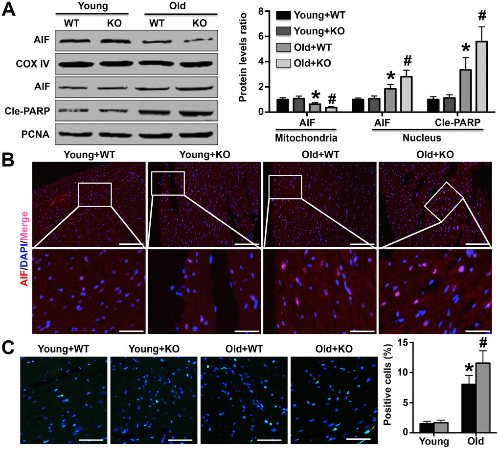 Effects of IL-12p35 KO on cardiomyocyte apoptosis. (A) Mitochondrial AIF expression and nuclear AIF and Cle-PARP expression were measured by Western blotting analysis. (B) Cardiac AIF expression was detected by immunofluorescence staining (200x). (C) TUNEL staining was performed to mark the apoptotic cells and the positive cell numbers in each group (200x). * p# p